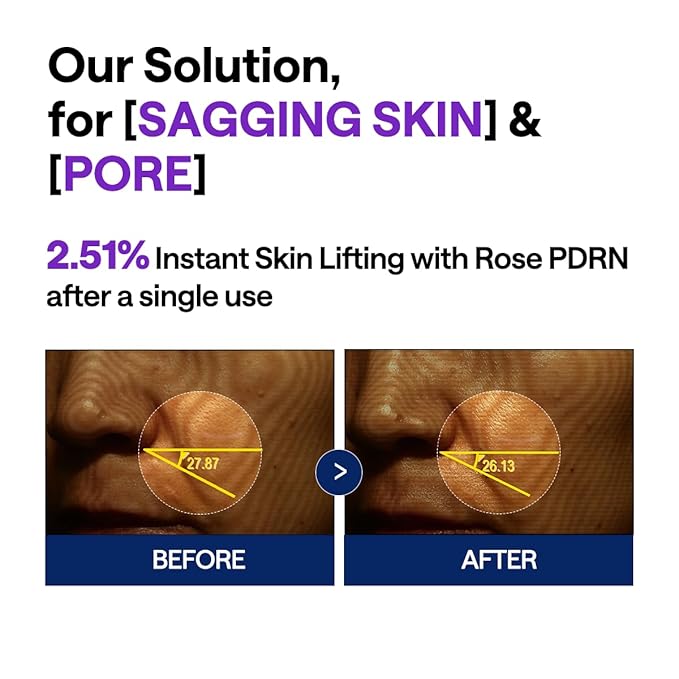 Mediheal PDRN Lifting Serum with Squalane 1.35 fl.oz - Korean Face Serum for Natural Glass Glow Skin, Pore Care & Skin Firming, Deep Moisturization