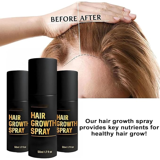 2PCS Hair Growth Spray,Hair Growth,Promotes Thicker, Fuller Hair For Women & Men – All Hair Types With Natural Ingredients