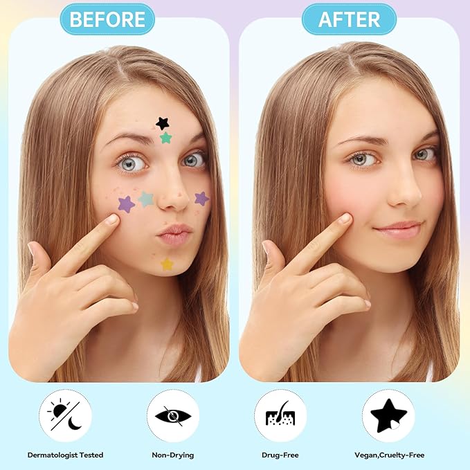 Pimple Patches for Face, Cute Star Zit Covers, Stars Hydrocolloid, For Sensitive Skin, with Tea Tree, Salicylic Acid & Cica Oil (10&12&14mm) 240 Count
