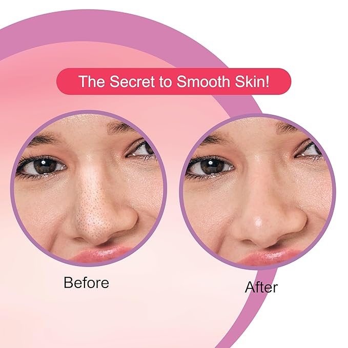 DR.RASHEL Strawberry Nose Pore Strips For Pore Cleansing, Instant And Painless Blackheads Removal | Deep Purifying Blackhead Remover Strips for Nose | 20 PCS (10 Strips & 10 Wipes)
