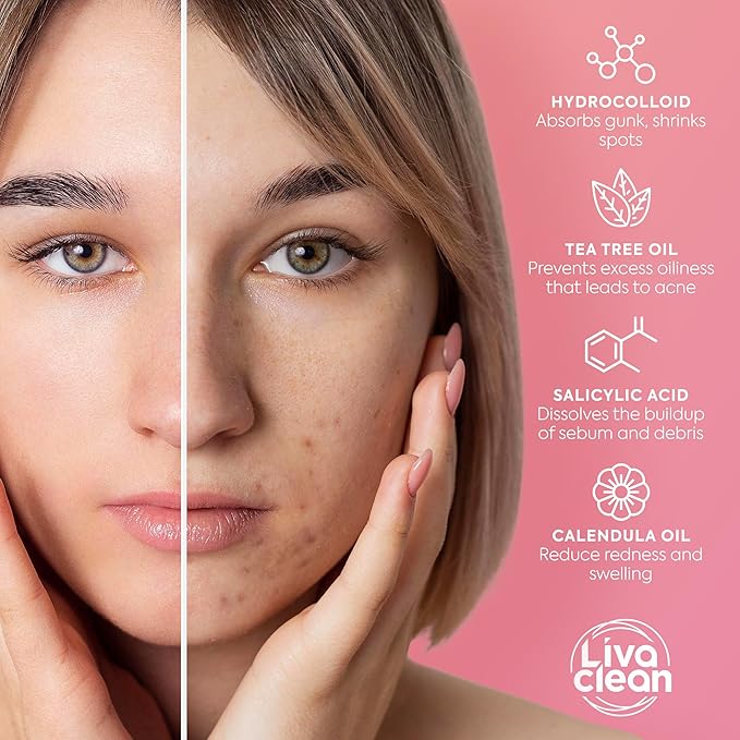 Livaclean 240 Star Pimple Patches for Face + 330 Round Hydrocolloid Acne Patches - Multiple Size Zit Stickers w/Salicylic Acid and Tea Tree Oil - Cute Invisible Acne Patch - Hydrocolloid Pimple patch