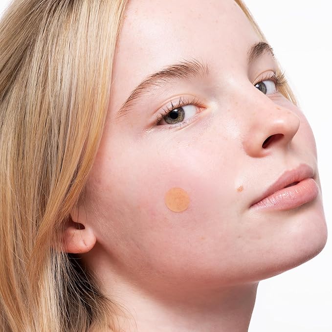 PEACE OUT Acne Healing Dots Helps Clear Blemishes Overnight, Fast Acting Hydrocolloid Pimple Patches for Breakouts with Salicylic Acid, Retinol and Aloe Vera, Award Winning Skincare Solution 40 Count