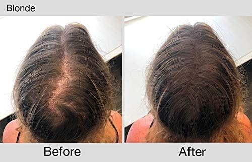 Joan Rivers Great Hair Day Root Touch Up Powder Duo - Fill-in Powder for Thicker, Fuller Looking Hair (Blonde)