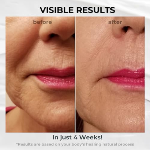 BIONOVA Anti-Aging Upper Lip Treatment with UV Chromophores - Reduce Mild to Deep Vertical Lip Lines, Lip Wrinkles and Prevent Lipstick Bleeding (0.5 oz)