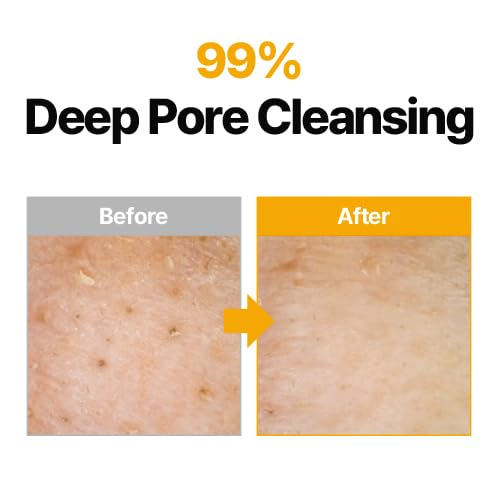 MANYO Pure Cleansing Oil, Natural Oil Cleanser for Face, Makeup Blackhead Remover, Korean Skin Care, 6.76 fl oz (200ml)