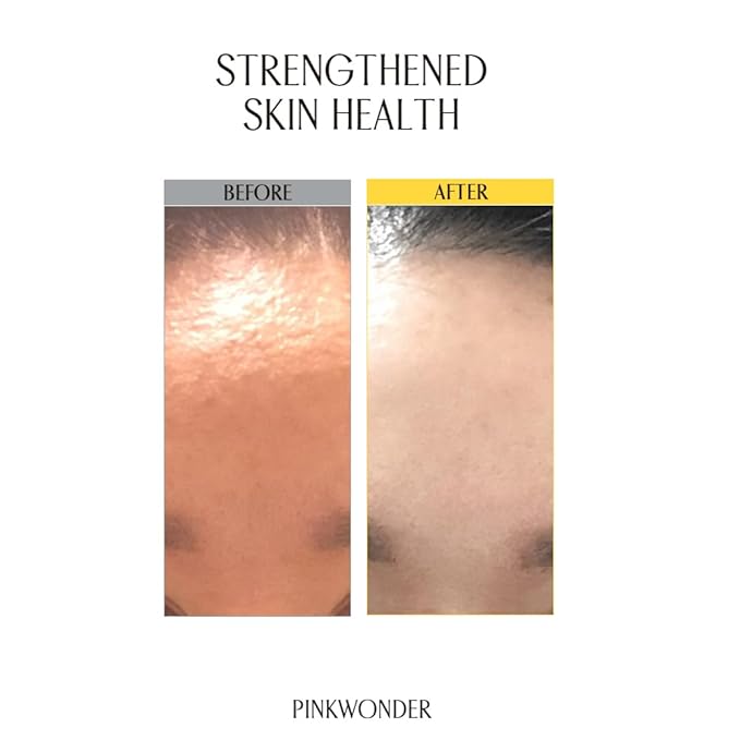 PINKWONDER Jojoba Barrier Plus Cream 1.69oz(50ml), 24HR Long Lasting facial Moisturizier Face Cream, Jojoba Oil and Hyaluronic Acid for Dry Sensitive Skin, Korean Skin Care