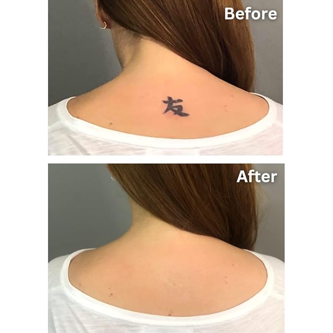 Dermaflage Tattoo Cover Up Makeup (Tan) - Bruise Full Coverage Concealer - Full Coverage Waterproof Concealer for Bruise, Scars & Acne - Smudge Proof Body Makeup Palette with 3 Pro SFX Shades + Brush