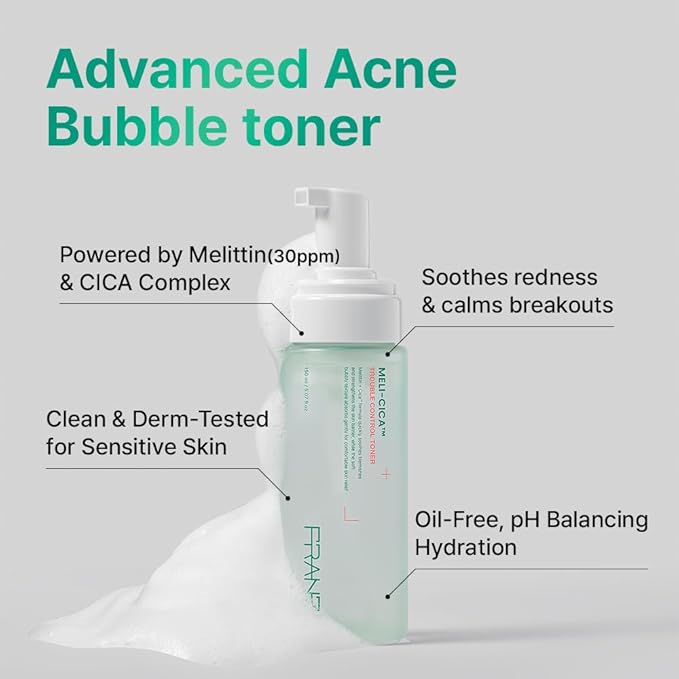 FRANZ Soothing Bubble Toner | Korean Skincare Acne Toner with CICA & Melittin | Calming & Redness Relief Formula | pH 6.0~6.5 Balancing & Oil Control for Sensitive, Acne-Prone Skin