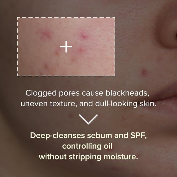 3W8L Deep Off & Fresh Cleansing Oil – Fast emulsifying Korean pore care cleanser, gentle daily makeup & sunscreen remover with Jojoba & Centella, dissolves sebum & blackheads, hydrating fresh finish