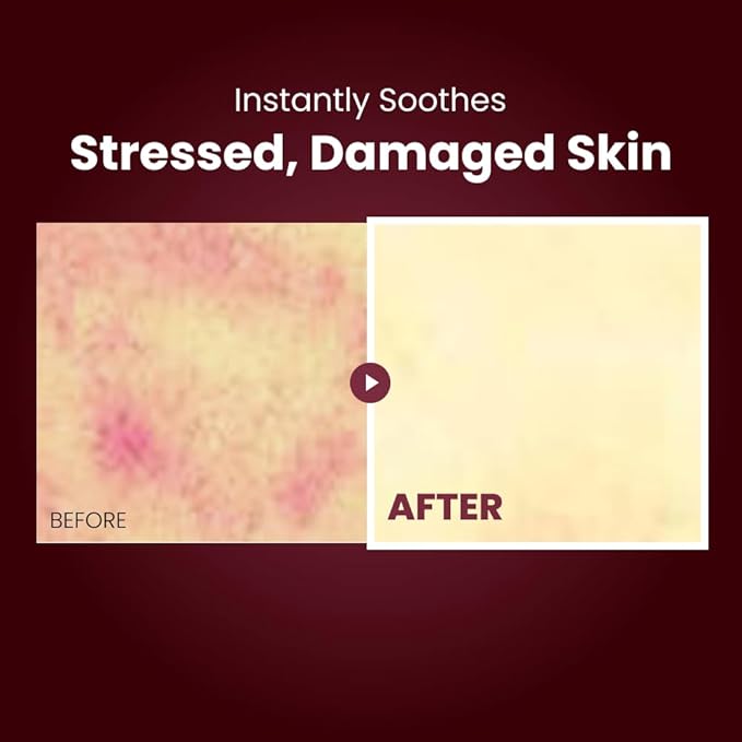 Kopher Curepair Derma Ampoule Mist [4ever Edition] with 10GF Skin Renewal & Brightening Ampoule for Sensitive Skin - Reduces Wrinkles, Improves Skin Tone, Korean Skincare (3.38 fl.oz.)