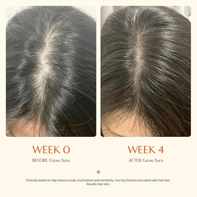 lilyeve GROWTURN Hair Growth Serum with Built-in Brush, Heartleaf-Derived Exosomes to Revitalize Hair, Hair Thickening, Hair Growth Accelerator - Korean Hair Care, 3.38 fl. oz. (Pack of 1)