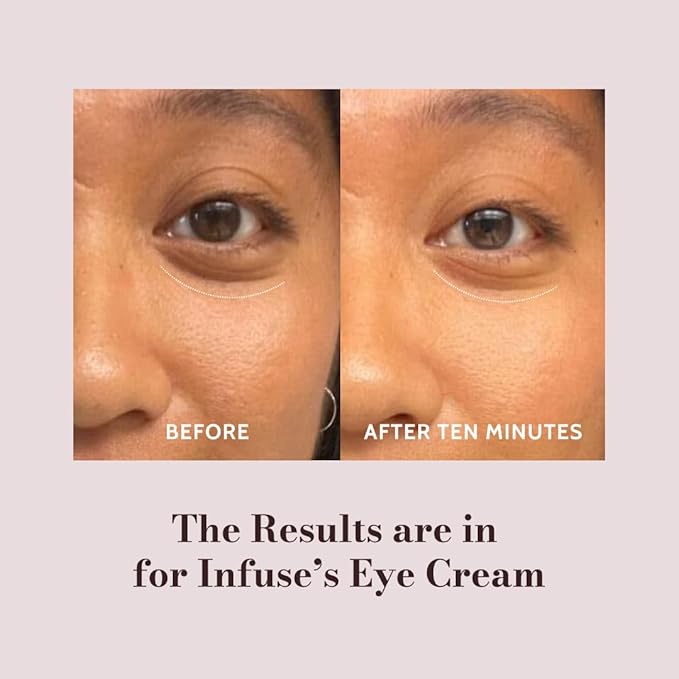 Infuse Yerba Mate Eye Cream 30ml – Caffeine & Peptide Anti-Aging Eye Treatment for Dark Circles, Puffiness & Wrinkles – Hydrating Firming Under Eye Cream for Mature Skin