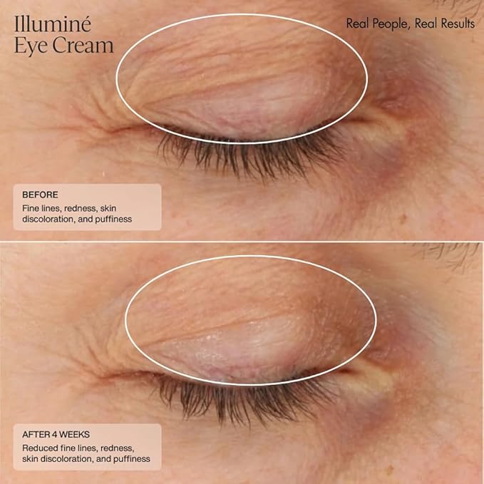 Senté Illuminé Eye Cream | Diminish Dark Circles, Discoloration, Redness, and Puffiness Around The Eyes | with Patented HSA, Niacinamide and Peptides | 0.5 Oz