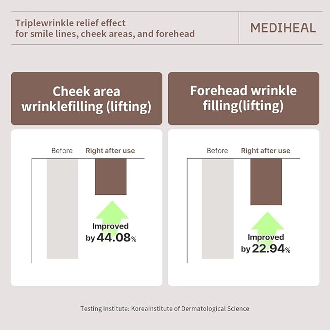 Mediheal Retinol Collagen Cream Lifting Mask (4 Counts) for V Line Mask,Anti-Aging - Helps Reduce Fine Lines & Wrinkles, and Smoothens Skin