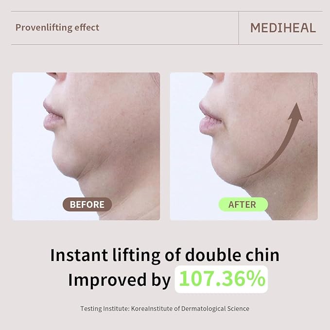 Mediheal Retinol Collagen Cream Lifting Mask (10 Counts) for V Line Mask, Anti-Aging - Helps Reduce Fine Lines & Wrinkles, and Smoothens Skin