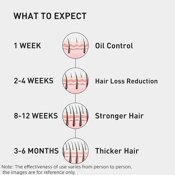 0.5% KINTOR KX-826 Hair Growth Spray,Oil Control Strengthen Hair,Hair Regrowth Products for Women&Men,Basic,240ml