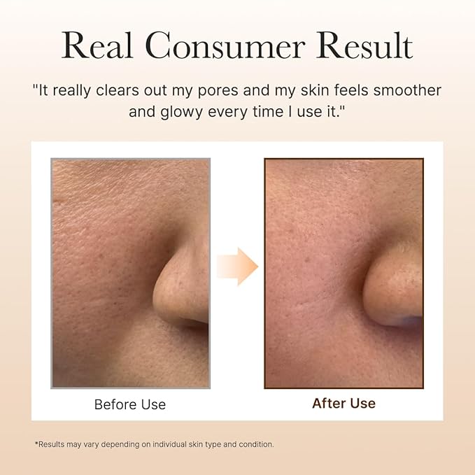 ARENCIA Calendula Rice Mochi Fresh Cleanser - Moisturizing, Brightening & Deep-Cleansing (4.23oz)