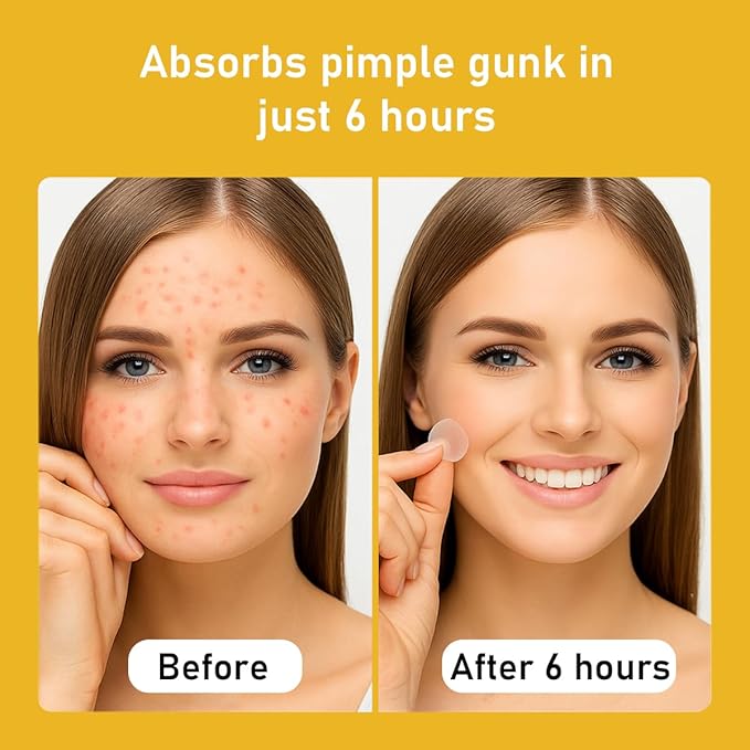 Pore Minimizing Gel | Daily Blackhead Dissolving Gel with Jojoba Beads, Non-Comedogenic, for Oily/Acne-Prone Skin