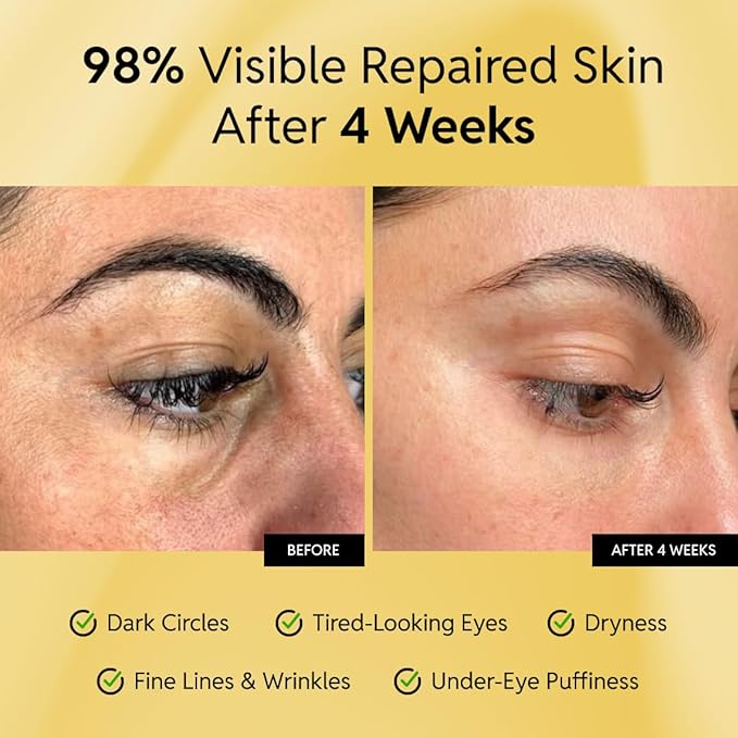 Repair Hydrating Eye Cream – Reduces Dark Circles, Puffiness and Fine Lines – Lightweight, Dermatologist-Recommended, Fast-Absorbing and Sensitive Skin Friendly -15ml