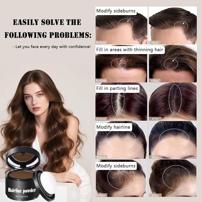 Invisible Hairline Powder, Undetectable Coverage for Bald Spots Receding Hairlines, 3 Seconds Fill for Bald Spots & Thinning Edges, Waterproof, Transfer-Resistant, Natural Matte Finish