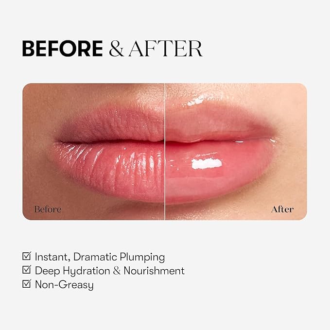 VTCOSMETICS Reedle Shot Lip Plumper, 0.15 oz (4.3 g), Moisturizing, Transparent, Lip Gloss, Stocking Stuffers, Fragrance-free, Korean Cosmetics (Expert)
