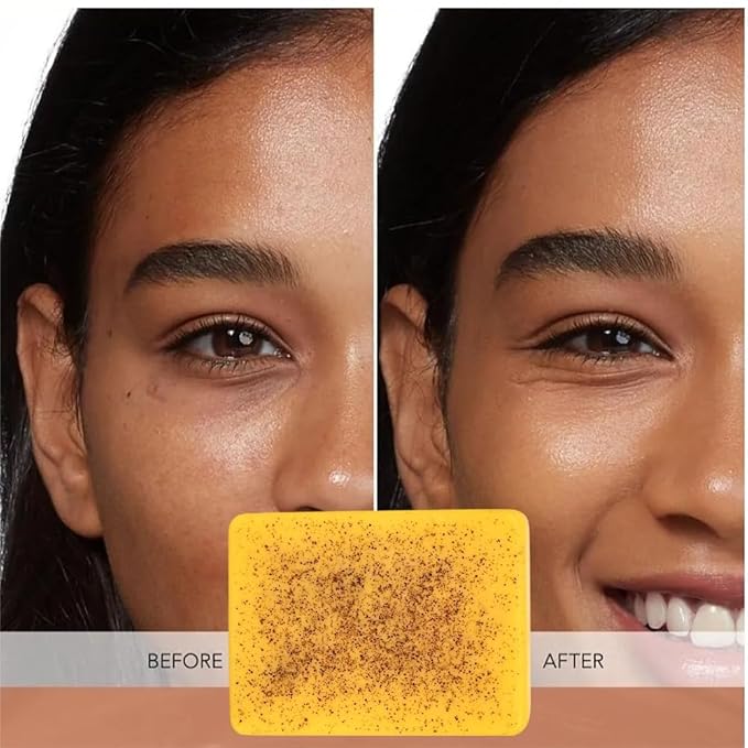 Lemon & Turmeric Glow Soap Bar - Brightening Bar for Dark Spots & Acne Scars, with Kojic Acid, Vitamin C, Retinol, Shea Butter -30% Larger & SLS Free, for Oily & Dry Skin