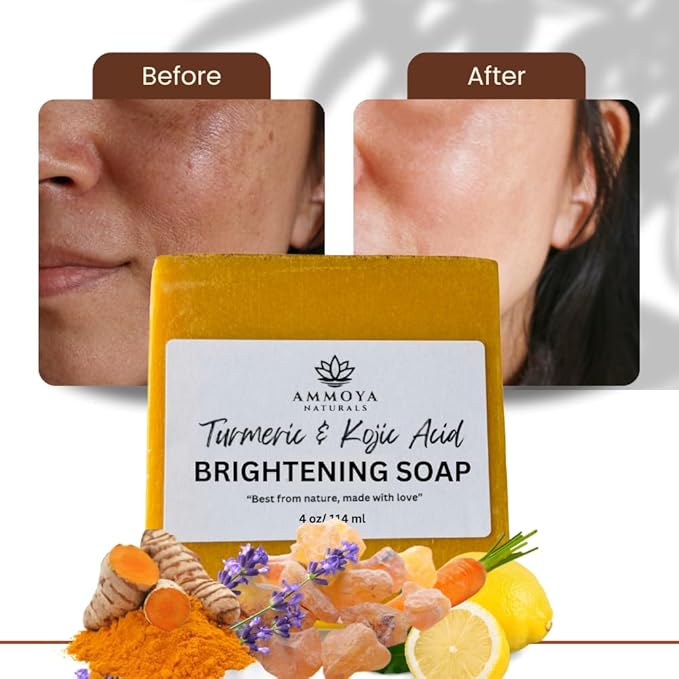 Turmeric Skin Cleansing Soap - Natural Glow Face & Body Cleanser for Acne, Dark Spots & Scars, Gentle for All Skin Types - 2 Bars (4.5 oz)