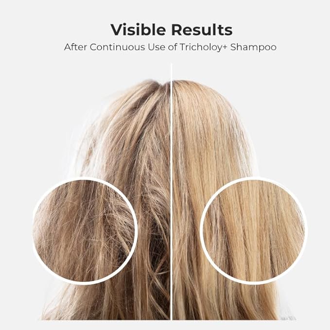 Volumizing & Thickening Shampoo for Fine & Thin Hair – Biotin Root Lift Formula for Fuller Hair, Oil Control & Scalp Care – 10 fl oz (2)