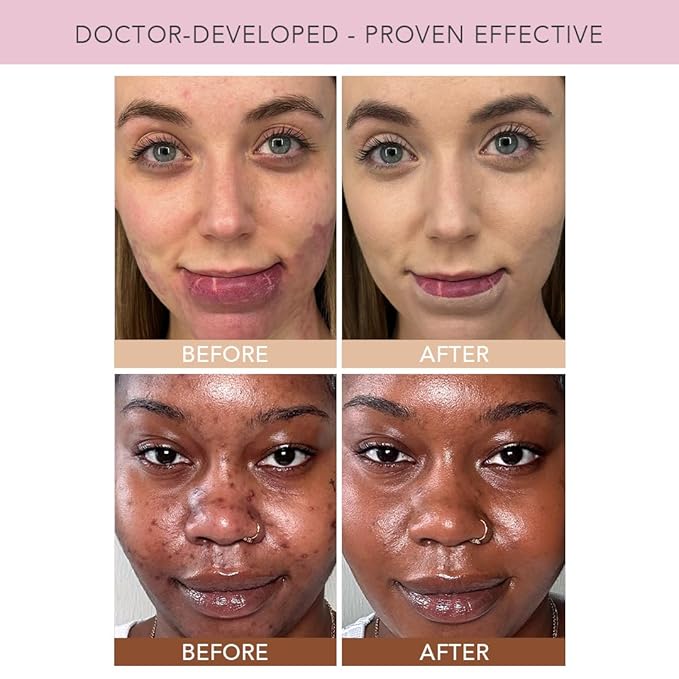 Doll 10 TCE Liquid Filter – CC Cream - Liquid Foundation - Lightweight Tinted Moisturizer & Skin Tint - Blurs Pores & Fine Lines - Vegan - Clean Makeup - [ Deep ] - 30 Day Supply