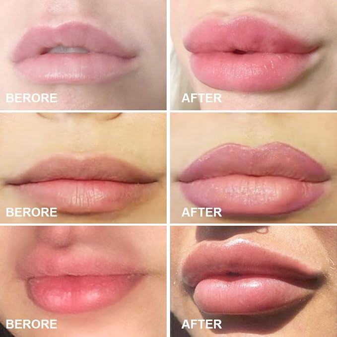 Lip Plumper Device Lip Filler Beauty Pump,Soft Material Pout Lips Enhancer Plumper Tool, Natural Pout Mouth Tool, City Lips Lip Plumper Full of charm Lip plump