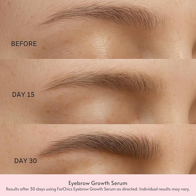 Eyebrow Growth Serum by ForChics - Natural Brow Thickening Treatment with Peptides and Biotin- Hormone-Free, Vegan and Cruelty-Free- Fuller Brows in 2 Weeks- 0.10oz/3ml