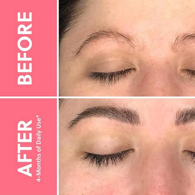 ForBrow by ForChics: 2 Pack Eyebrow Enhancing Serum - Thicker, Fuller Brows with Natural & Organic Conditioner | Vegan & Cruelty-Free with Innovative Peptides