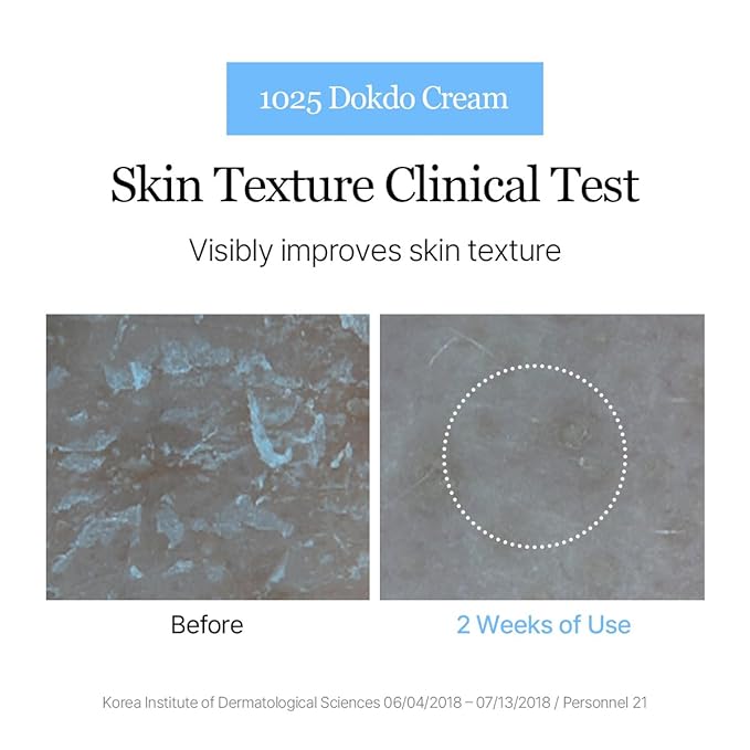 ROUND LAB Hydrating Face Moisturizer Duo for Sensitive Acne-prone Skin, Birch Juice Moisturizing Cream and Dokdo Cream,2.71 Fl Oz Lightweight Daily Face Cream Set, Barrier Cream, Korean Skin Care