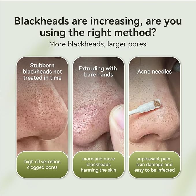 LANBENA 2.0 Blackhead Nose Plants Pore Strips(1.03 Oz), 60pcs Nose Strips for Blackhead Mask, Deep Cleansing Peel off Mask, Black Head Remover Mask