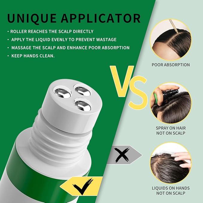 W3W Hair Growth Serum with Rosemary, Fermented Rice & Caffeine - Roll-On Scalp Treatment for Thinning Hair, No Minoxidil, Fast-Absorbing, Non-Greasy Formula for Women & Men