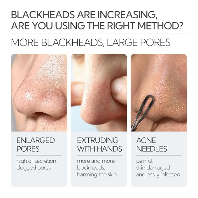 LANBENA 3 in 1 Blackhead Removing Set, Pore Strips 30g+Pore Serum 30ml+Removal Strip Paper, Black Head Remover Mask for Face, Pore Minimizer & Reducer for Face, Leaving Your Skin Fresh and Clean