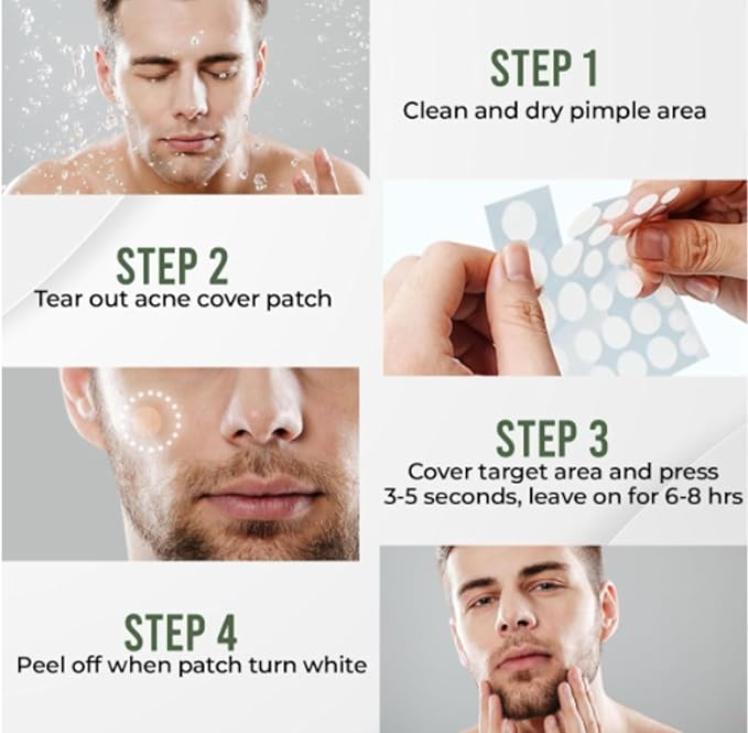 Clear Pimple Patches – 108 Ct Hydrocolloid Acne Patches w/ Salicylic Acid & Tea Tree Oil – Fast-Acting Zit Stickers for Face, Blemish & Spot Treatment – Invisible, Waterproof, Gentle for All Skin
