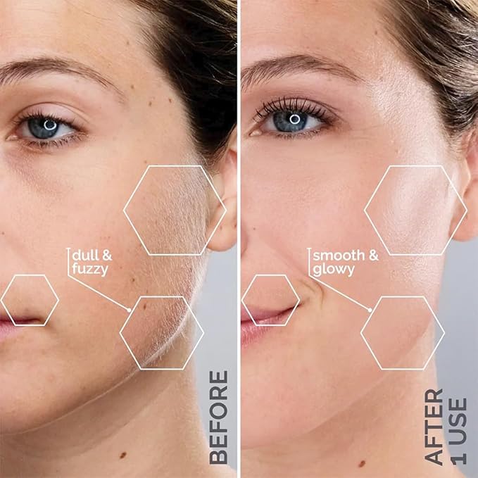 Michael Todd Beauty Sonicsmooth Dermaplane Razor for Women Face + Eyebrow trimmer Dermaplaning System - Peach Fuzz Remover - 8 Weeks of Dermaplaning Blades