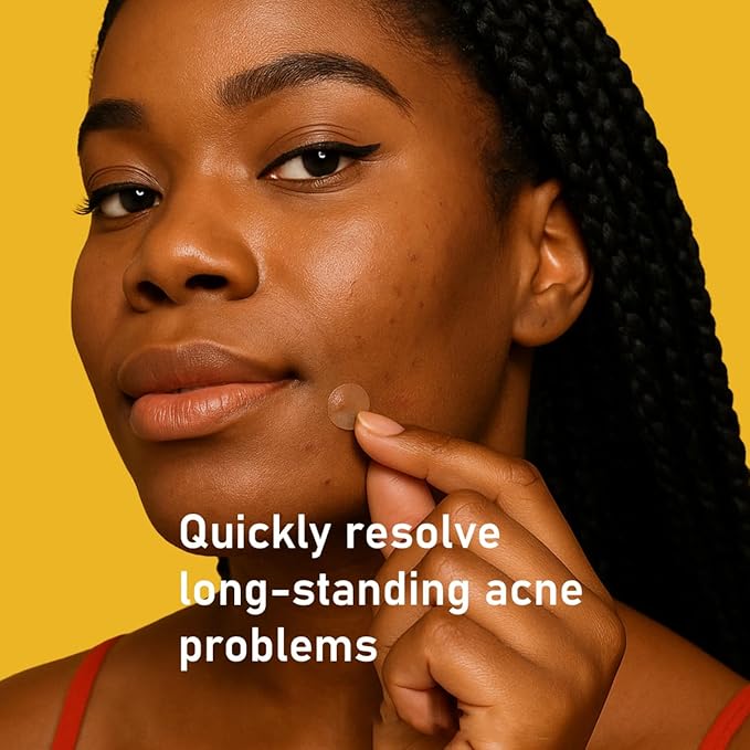 Pore Minimizing Gel | Daily Blackhead Dissolving Gel with Jojoba Beads, Non-Comedogenic, for Oily/Acne-Prone Skin