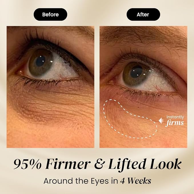 Firming Eye Cream – Lifts and Tightens Sagging Skin – With Arginine/Lysine Peptides and Ceramide – Fast Action -Reduces Fine Lines, Wrinkles and Improves Elasticity – Dermatologist-Tested- 15ml