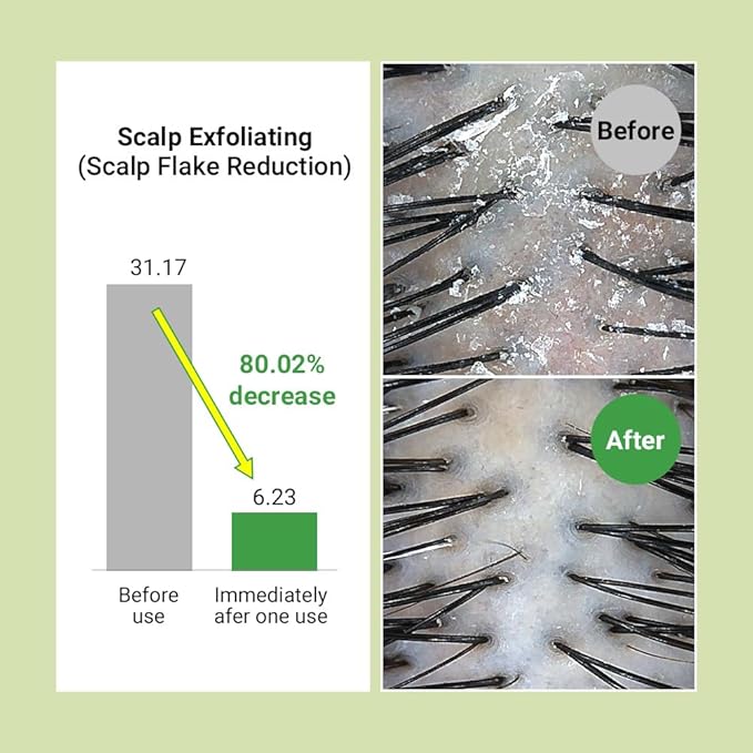 RATED GREEN Real Mary Exfoliating Dry Scalp Shampoo, 13.52 fl oz - Organic Rosemary Hair for Itchy , Gentle Scalp Moisturizer, with Ginger & Peppermint Oil