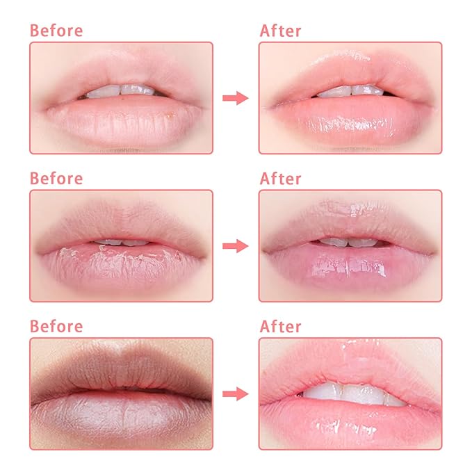 5 Pcs Bee Lip Balm Honey Pot, Honey Strawberry Apple Lip Mask Overnight, Moisturizing Lip Sleeping Mask, Hydrate Repair Prevent Dry Cracked Lip Exfoliator Lip Care