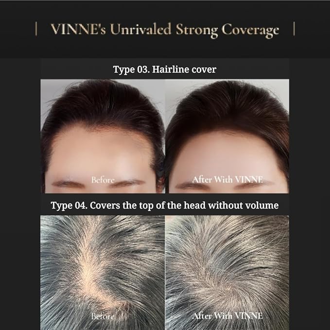 Vinne 2-Color Hair Cushion Stick: Waterproof Gray Cover, Long-Lasting Root Filler & Nutrient-Rich Care (Natural Black, Dark Brown)