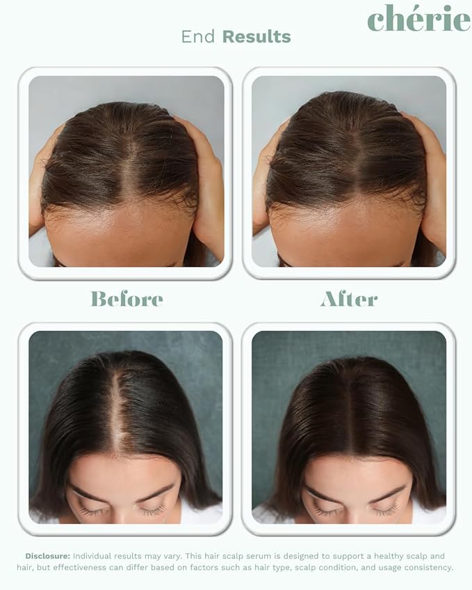 Hair Growth Serum for Scalp with Caffeine and Peptides, Lightweight Formula for Women with, Peptide Scalp Serum Nourishes Roots, Supports Thicker Fuller Strands, and Reduce Visible hair Loss- 3.38 oz