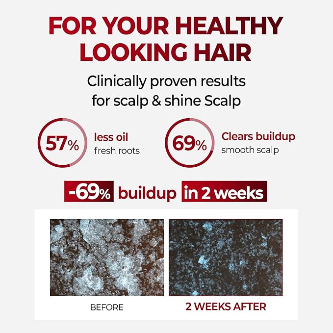 KUNDAL Caffeine Scalp Shampoo [Baby Powder] – Sulfate-Free Korean Hair Care with Menthol & Botanical Extracts – For Fuller-Looking Hair, Scalp Refresh & Strength – 16.9 Fl Oz, Stocking Stuffers
