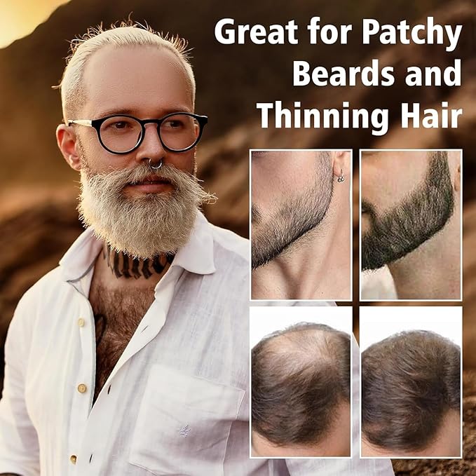 Root Cover Up Powder Hairline Powder for Women Root Touch Up Hair Color for Bald Spots, Eyebrows, Beard Line, Light-Blonde Hair Fibers for Thinning Hair Shadow Cover Up 2 Pack (Light Brown)