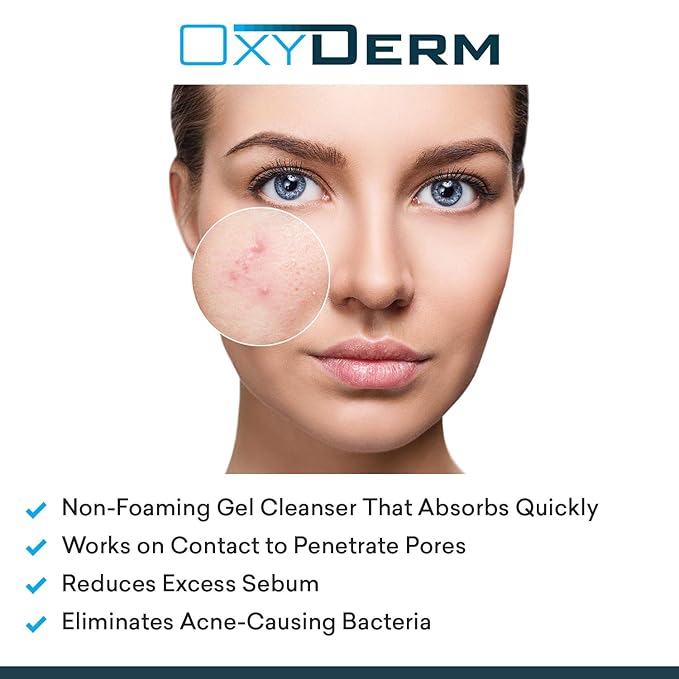 Benzoyl Peroxide 10% Cleanser Wash Treatment - Clears Cystic Breakouts & Fights Acne Blemishes on Contact. Prevents Future Pimples, Blackheads, Whiteheads, Zits, Bumps. Face & Body for Teens & Adults.