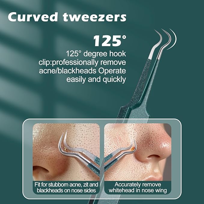 WSYUB Upgrade Professional Facial Blackhead Remover Tweezers, Ingrown Hair Tweezers,Extractor Acne Removal, Pimple Popper Tool,Green
