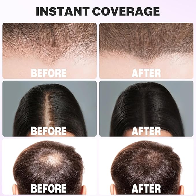 Acomler Instantly Root Cover Up Hairline Shadow Powder, Root Touch Up Hair Color 0.35 Ounce for Thinning Hair, Grey Hair Coverage, Hair Powder for Women Men, Beard Line, Bald Spots (Medium Brown)