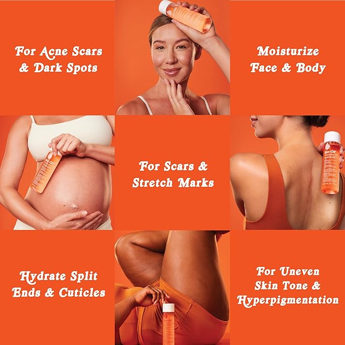 Bio-Oil Skincare Body Oil Serum for Sensitive and Dry Skin, Face and Body Moisturizer for Scars & Stretch Marks, Hydrates with Vitamins E & A, Dermatologist Recommended, 0.85 Oz (Pack of 3)